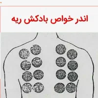 حجامت تخصصی ماساژ درمانی دیسک سیاتیک
