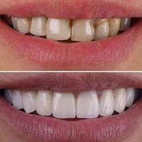 استخدام خانم دستیار دندانساز و مستخدم کلینیک بوعلی