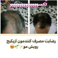 خیلی راحت بدون رژیم سخت چربیسوزی کن|آرایشی، بهداشتی، درمانی|سبزوار, دانشگاه آزاد|دیوار