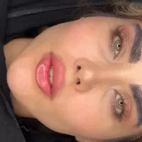 تزریق تخصصی ژل کانتورینگ صورت وزاویه فک وفیشیال