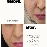 خدمات زیبایی کلینیک فارا دامغان|خدمات آرایشگری و زیبایی|دامغان, |دیوار