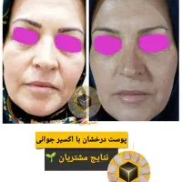 اکسیر جوانی پوست 100درصد خالص تضمینی