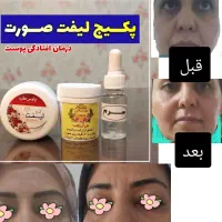 کرمهای گیاهی بر پایه خاویار حلـزون|آرایشی، بهداشتی، درمانی|شیراز, شهرک سعدی|دیوار