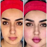 هایفو و جوانسازی پوست ویژه جشنواره یلدا ۸۹۰ت|خدمات آرایشگری و زیبایی|اصفهان, پروین|دیوار