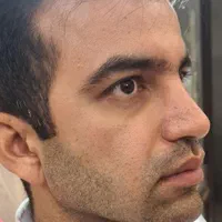 ژل بوتاکس مزوتراپی prp با قیمت استثنائی توسط پزشک|خدمات آرایشگری و زیبایی|اسلام‌شهر, باغ فیض|دیوار