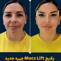 فیلر بادی باسن سینه بیکینی دست غبغب شکم دکتر زنان|خدمات آرایشگری و زیبایی|مشهد, هفت تیر (آب و برق)|دیوار
