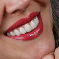 جشنواره کامپوزیت لمینیت روکش عصب ترمیم IMAX دندان