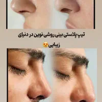 ساکشن شکم پهلو ۱۰ میلیون تومان ، پزشک ۲۰ سال تجربه|خدمات آرایشگری و زیبایی|مشهد, هفت تیر (نه دره)|دیوار