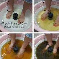 سمزدایی بدن با یون تراپی هم اقایان هم بانوان