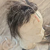پروتز مو  ترمیم تعویض چسب