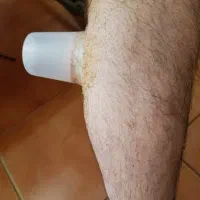 حجامت در محل شما بدون ایاب ذهاب