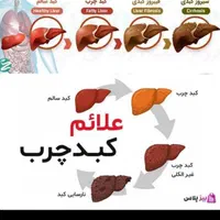 کبدچرب تو با اصلاح مزاج درمان کن|خدمات آرایشگری و زیبایی|گنبد کاووس, |دیوار