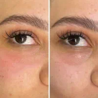 خدمات ژل و بوتاکس پلکسر و...|خدمات آرایشگری و زیبایی|کرمانشاه, |دیوار