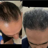 با این جاشو پر کن