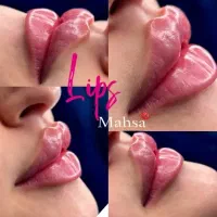 جشنواره پاییزه فیلر لب ژللب بوتاکس زاویه فک گونه|خدمات آرایشگری و زیبایی|کرج, مطهری|دیوار