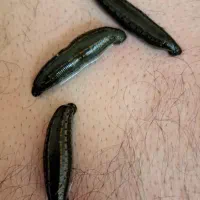 حجامت. بادکش درمانی. زالو درمانی|خدمات آرایشگری و زیبایی|یاسوج, |دیوار