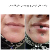 پوست زیبایی|خدمات آرایشگری و زیبایی|رباط‌کریم, الارد|دیوار