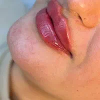 آف ژل وبوتاکس+آموزش تضمینی