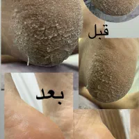 پدیکور پا (اموزش پدیکور) خدمات ناخن ، پاکسازی ، ا