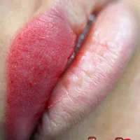 با قیمت استثنایی زیبایی چهره تو همیشگی کن