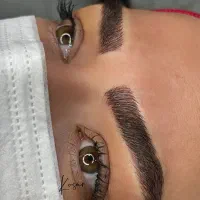 میکروبلیدینگ(فیبروز) شیدلب،بن مژه،خطچشم