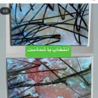 یلدایی کراتین ،ناخن ،فیشیال ،اسکالپ ،رنگ و دکلره