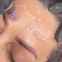 پوست یک دست و شیشه ای