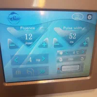 دستگاه لیزر الکس دایود|آرایشی، بهداشتی، درمانی|اصفهان, وحید|دیوار