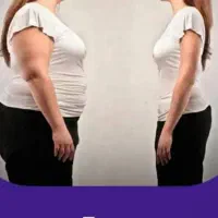 کلینیک لاغری، وزن با دارو مانجارو،جراحی، فیلر بادی