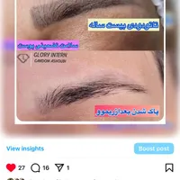 ریموو(پاک کردن تاتو)،میکروبلیدینگ،تاتوابرو|خدمات آرایشگری و زیبایی|رشت, منظریه|دیوار