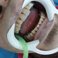 آموزش دندانپزشکی کامپوزیت|خدمات آموزشی|تهران, شهرک شریعتی|دیوار