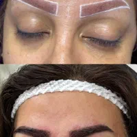 کاشت مو / ابرو / مژه|خدمات آرایشگری و زیبایی|تهران, زعفرانیه|دیوار