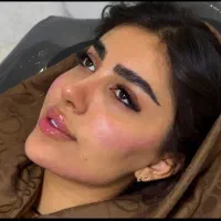 جشنواره  یلدایی تزریق ژل فقط و فقط هر سیسی ۱ ملیون|خدمات آرایشگری و زیبایی|همدان, |دیوار