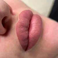 میکروبلیدینگ ورژلب دائم