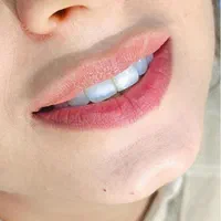 دندانپزشکی کامپوزیت و لمینت تخصصی،کامپوزیت دندان|خدمات آرایشگری و زیبایی|شیراز, عفیف‌آباد|دیوار