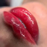 شیدینگ لب‌بدون درد