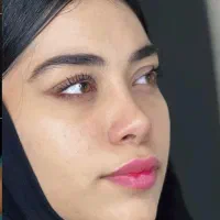 عمل بینی با متخصص بالای ۱۰۰۰ عمل موفق فقط با ۲۳ م|خدمات آرایشگری و زیبایی|تهران, جمال‌زاده|دیوار