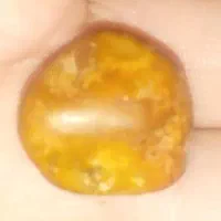 سنگهای موکل دار گبری و یهودی.