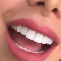 دندانسازی و دندانپزشکی حصارک بالا