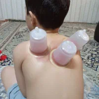 زالو|خزنده|زنجان, |دیوار