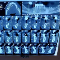 همکاری با دندانپزشک عمومی یا متخصص