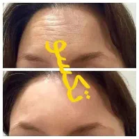 رفع تیرگی ، ناباروری،  چاقی صورت و بدن ، لاغری|آرایشی، بهداشتی، درمانی|زاهدان, |دیوار