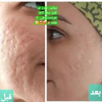 زیبایی و سلامتی پوست ومو|آرایشی، بهداشتی، درمانی|بابل, |دیوار