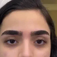 فوق تخصص اصلاح ابرو زنانه ۲۰سال سابقه وتدریس تهران