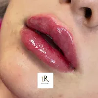 جشنواره ژل و بوتاکس|خدمات آرایشگری و زیبایی|اصفهان, مرداویج|دیوار