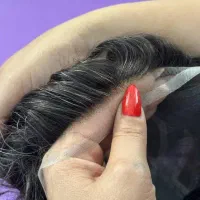 پروتز مو، با چک صیادی