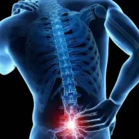 حجامت،فصد،اعمال یداوی(در منزل)|خدمات آرایشگری و زیبایی|مشهد, وحید|دیوار