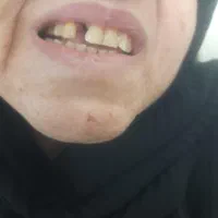 ساخت دندان مصنوعی ایرانی و خارجی|خدمات آرایشگری و زیبایی|رشت, دروازه لاکان|دیوار