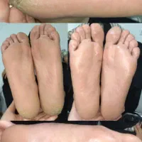 یه لحظه رد نکن بیا ببین پدیکور پارو|خدمات آرایشگری و زیبایی|محمدیه-قزوین, |دیوار