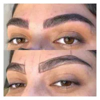 مدل برای فیبروز نیازمندیم